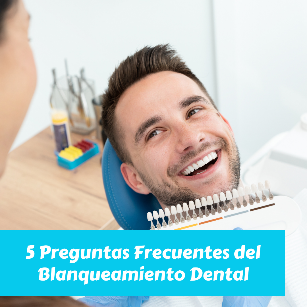 blanqueamiento dental