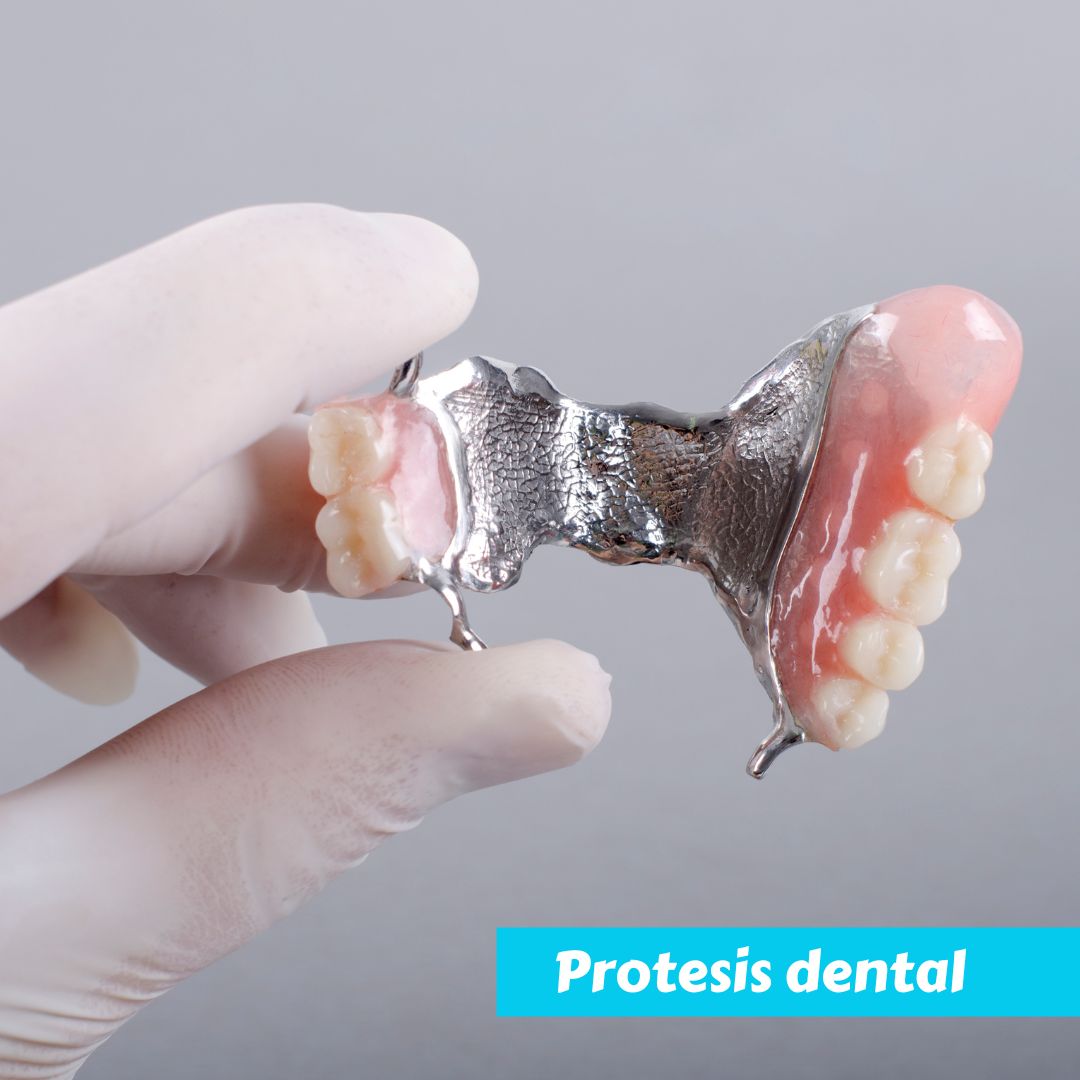 protesis dental
