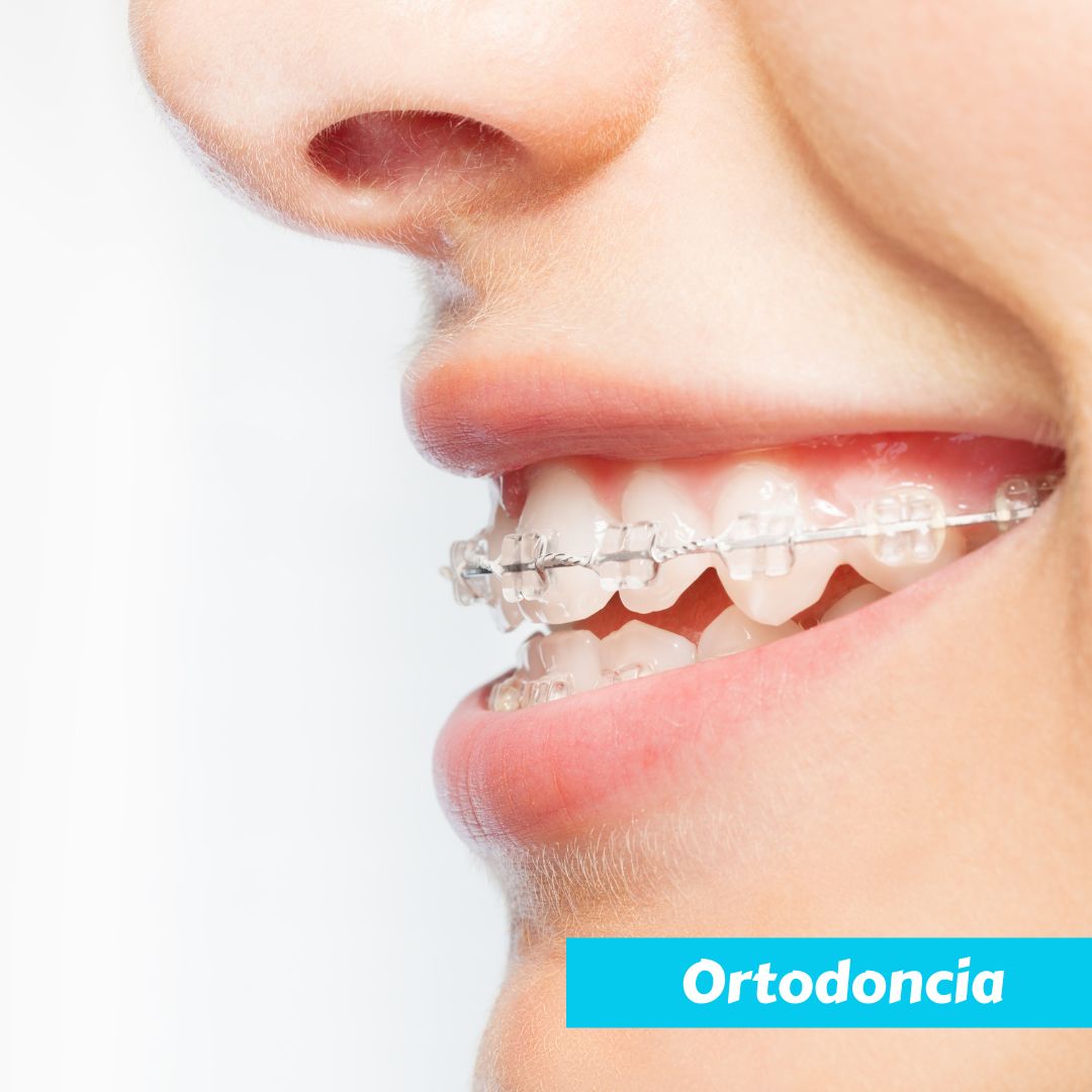 ortodoncia