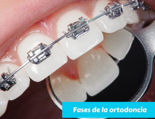 CONOCE LAS FASES DE LA ORTODONCIA